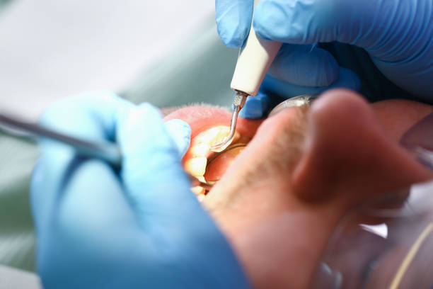 Best Dentist for Tooth Abscess  in Pompton Lakes, NJ
